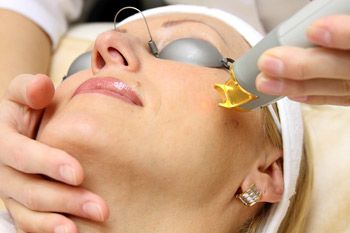 Процедура термолифтинга Процедура термолифтинга